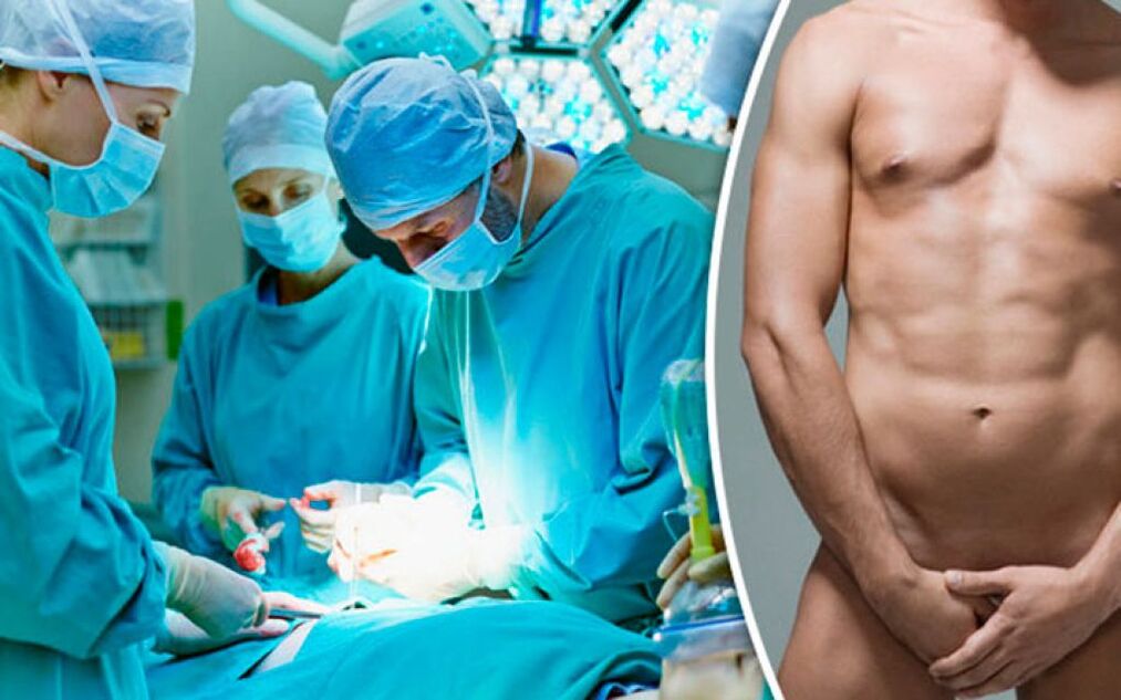 penisvergroting chirurgie