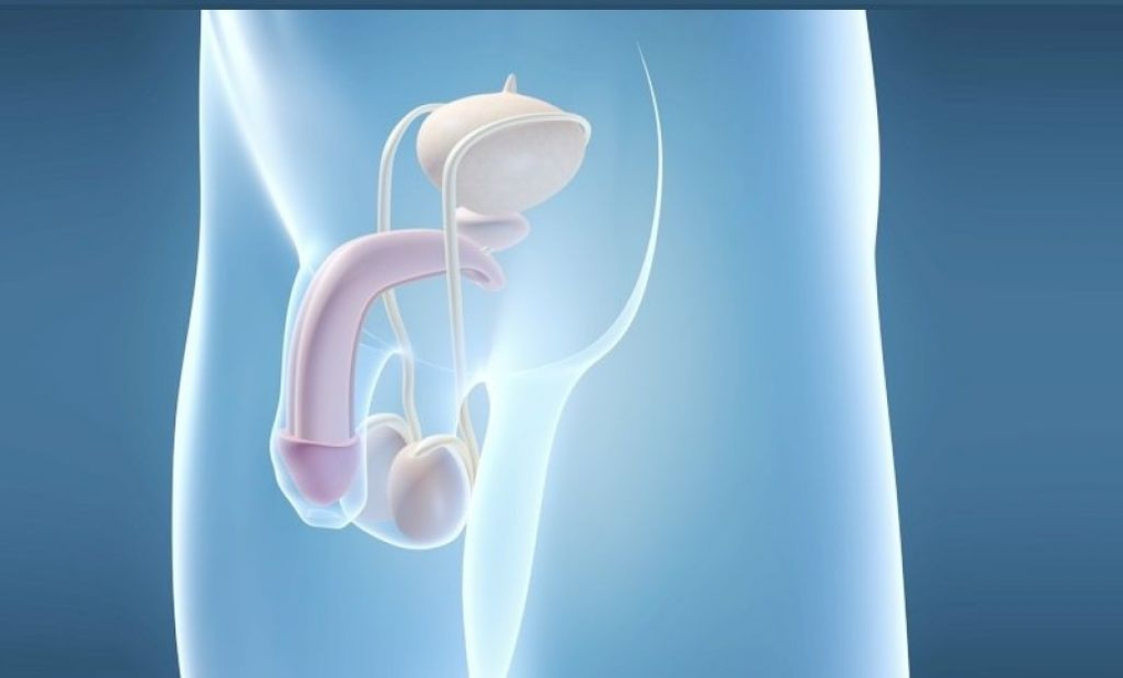 Prothese-implantatie is een chirurgische methode om de mannelijke penis te vergroten